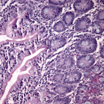 Purple-stained microscopic tissue sample showing cellular structures and patterns
