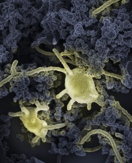 MK-D1-for-Microbe-of -the-Month.jpg