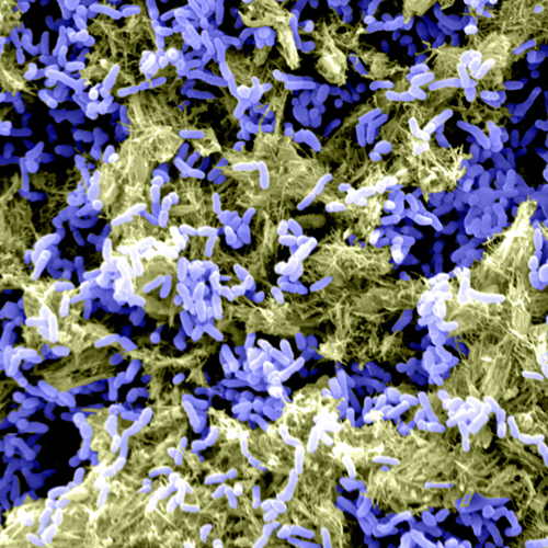 Microscopic image of Pseudomonas aeruginosa biofilms.
