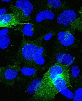 Microscopic image showing multiple blue stains on a dark background.