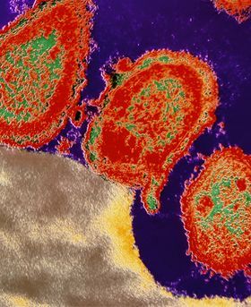 Microscopic image showing multiple red stains on a dark background.