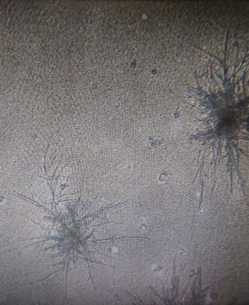 Microscopic image of cells.